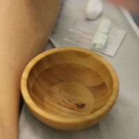 Acupuncture sessions at the Caen Normandy University Hospital maternity ward