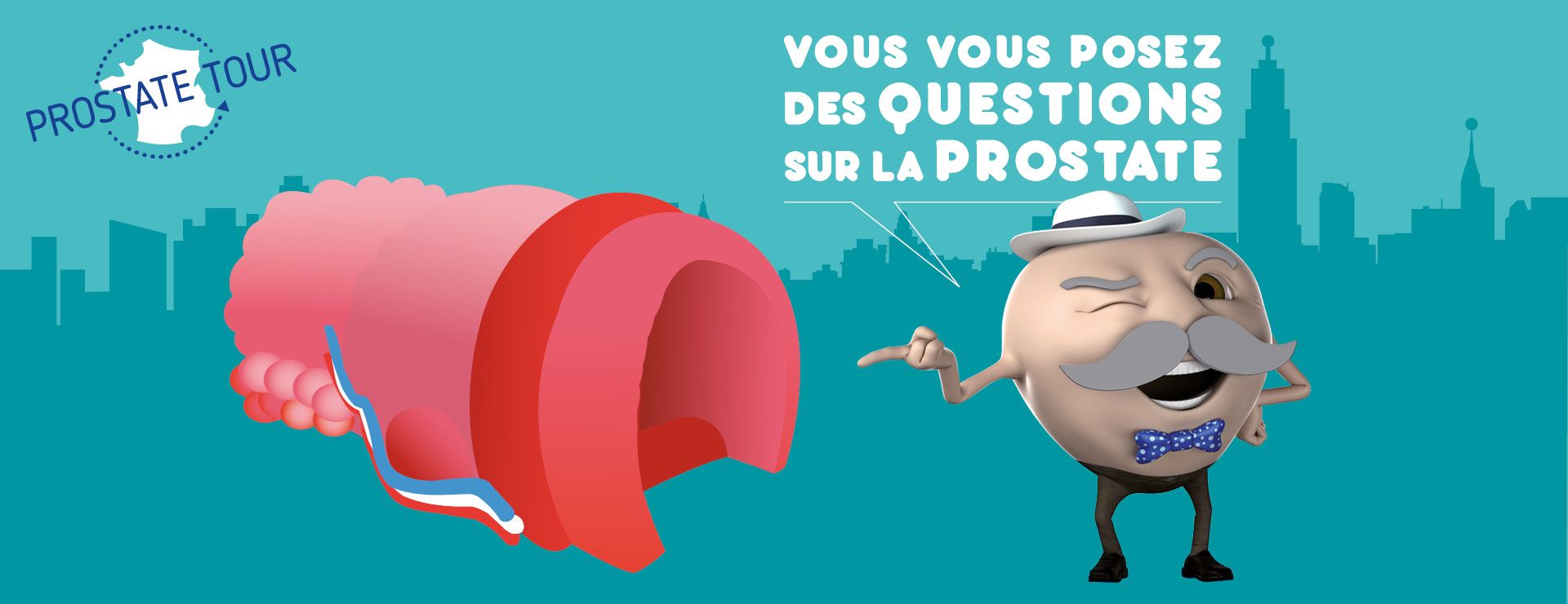 La próstata gigante se detiene en Caen