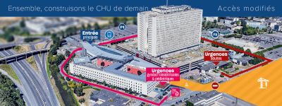 Modalité d'accès au CHU à partir du 19 août 2024