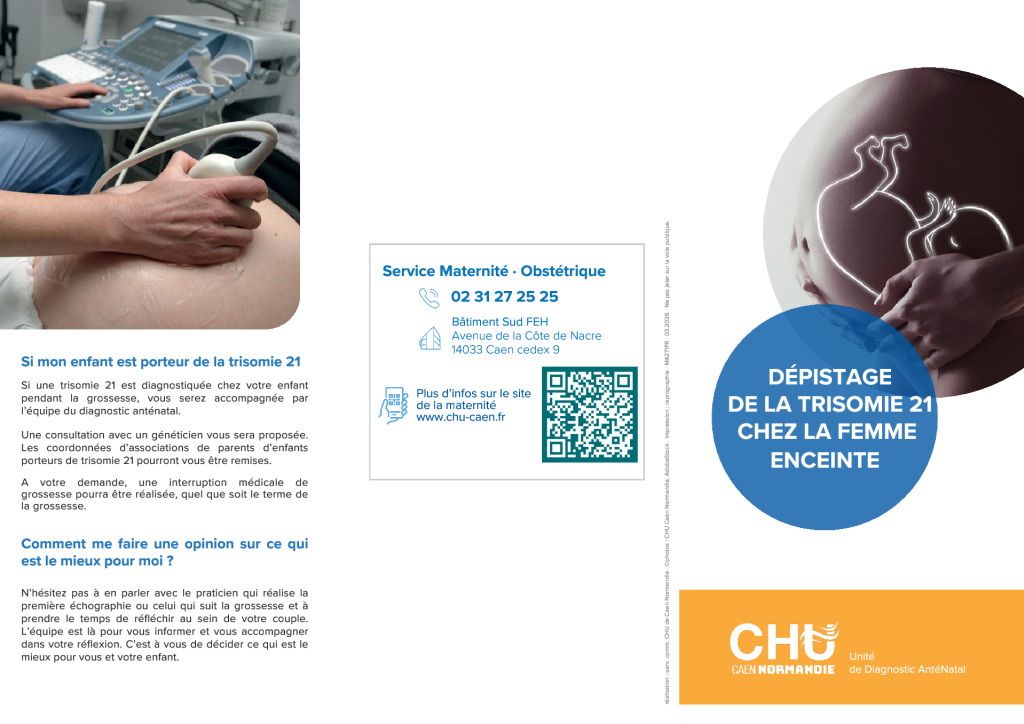 Dépistage T21 Dépistage T21