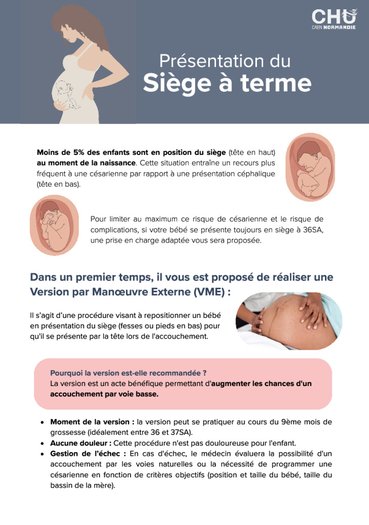 Siège